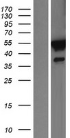 FKBP51 (FKBP5) Human Over-expression Lysates NM_001145775