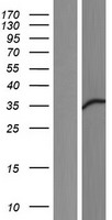 FKBP51 (FKBP5) Human Over-expression Lysates NM_001145777