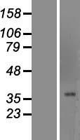 FOXG1 Human Over-expression Lysates NM_005249