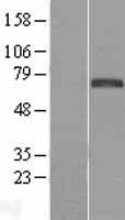 FOXC1 Human Over-expression Lysates NM_001453