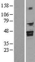FOXI1 Human Over-expression Lysates NM_012188
