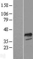 FOXI1 Human Over-expression Lysates NM_144769
