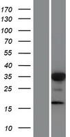 FOXL1 Human Over-expression Lysates NM_005250