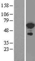 FOXC2 Human Over-expression Lysates NM_005251