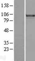 FOXM1 Human Over-expression Lysates NM_202003