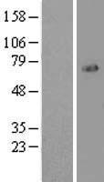 FOXO1 Human Over-expression Lysates NM_002015