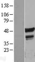 FLI1 Human Over-expression Lysates NM_002017