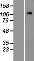 FLT3 Human Over-expression Lysates NM_004119