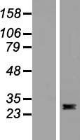 Flt3 ligand (FLT3LG) Human Over-expression Lysates NM_001459
