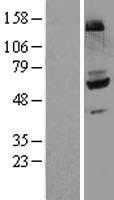 Flavin containing monooxygenase 4 (FMO4) Human Over-expression Lysates NM_002022
