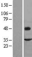 Fibromodulin (FMOD) Human Over-expression Lysates NM_002023