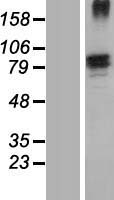 Fibronectin (FN1) Human Over-expression Lysates NM_212474