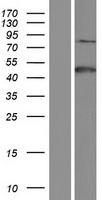 PSMA (FOLH1) Human Over-expression Lysates NM_001193473