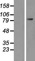 PSMA (FOLH1) Human Over-expression Lysates NM_004476