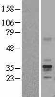 Folate Binding Protein (FOLR1) Human Over-expression Lysates NM_016725