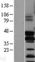 Fos B (FOSB) Human Over-expression Lysates NM_006732