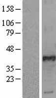 FRA2 (FOSL2) Human Over-expression Lysates NM_005253