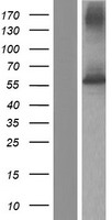 ls002356 folylpolyglutamate synthase fpgs human over expression lysates nm 001018078 wb testing 1