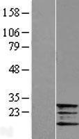 Frataxin (FXN) Human Over-expression Lysates NM_000144