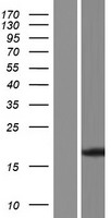 Frataxin (FXN) Human Over-expression Lysates NM_001161706