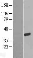 FRG1 Human Over-expression Lysates NM_004477