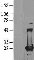 Ferritin Heavy Chain (FTH1) Human Over-expression Lysates NM_002032