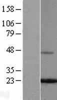 Ferritin Light Chain (FTL) Human Over-expression Lysates NM_000146