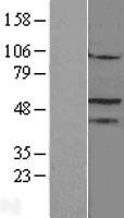 Steroidogenic Factor 1 (NR5A1) Human Over-expression Lysates NM_004959