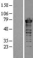 FUS Human Over-expression Lysates NM_004960