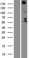 FUT8 Human Over-expression Lysates NM_178156
