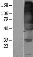 FVT1 (KDSR) Human Over-expression Lysates NM_002035