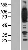 FYB1 Human Over-expression Lysates NM_001465