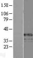 ls002538 glucose 6 phosphatase catalytic subunit g6pc human over expression lysates nm 000151 wb testing 1