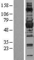 Glucose 6 Phosphate Dehydrogenase (G6PD) Human Over-expression Lysates NM_000402