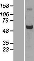 Glucose 6 Phosphate Dehydrogenase (G6PD) Human Over-expression Lysates NM_001042351