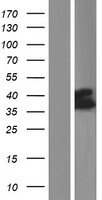 SLC37A4 Human Over-expression Lysates NM_001164279