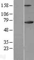 Ku70 (XRCC6) Human Over-expression Lysates NM_001469