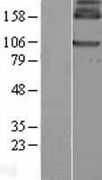 GABA B Receptor 1 (GABBR1) Human Over-expression Lysates NM_021904