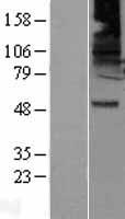 GABA A Receptor beta 2 (GABRB2) Human Over-expression Lysates NM_000813