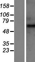 GABA A Receptor beta 2 (GABRB2) Human Over-expression Lysates NM_021911