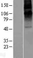 GABRE Human Over-expression Lysates NM_004961