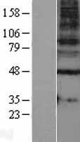 GABA A Receptor gamma 1 (GABRG1) Human Over-expression Lysates NM_173536