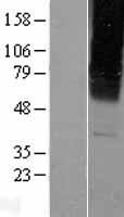 GABA A Receptor gamma 2 (GABRG2) Human Over-expression Lysates NM_198904
