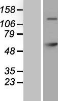 GAD65 (GAD2) Human Over-expression Lysates NM_000818