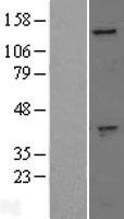ls002580 gak human over expression lysates nm 005255 wb testing 1