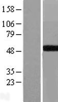 ls002592 galt human over expression lysates nm 000155 wb testing 1