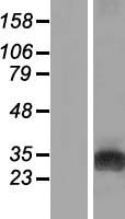 GAMT Human Over-expression Lysates NM_138924