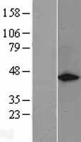 GAP43 Human Over-expression Lysates NM_002045