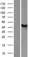 GART Human Over-expression Lysates NM_175085