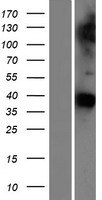 GAS1 Human Over-expression Lysates NM_002048